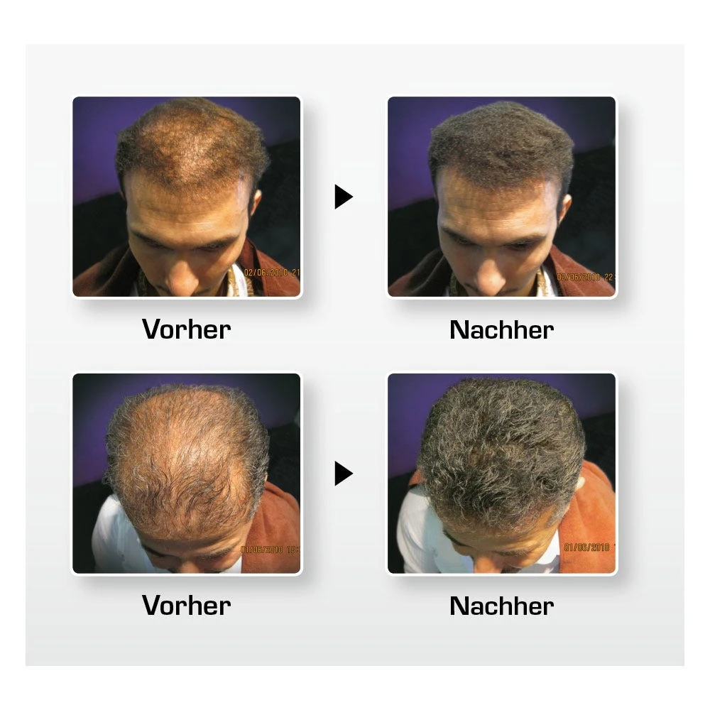 BioThik Haaraufbau-Faser S7 Hellblond 25 G 2 BioThik Haaraufbau-Faser S7 Hellblond 25 G – Bild 2