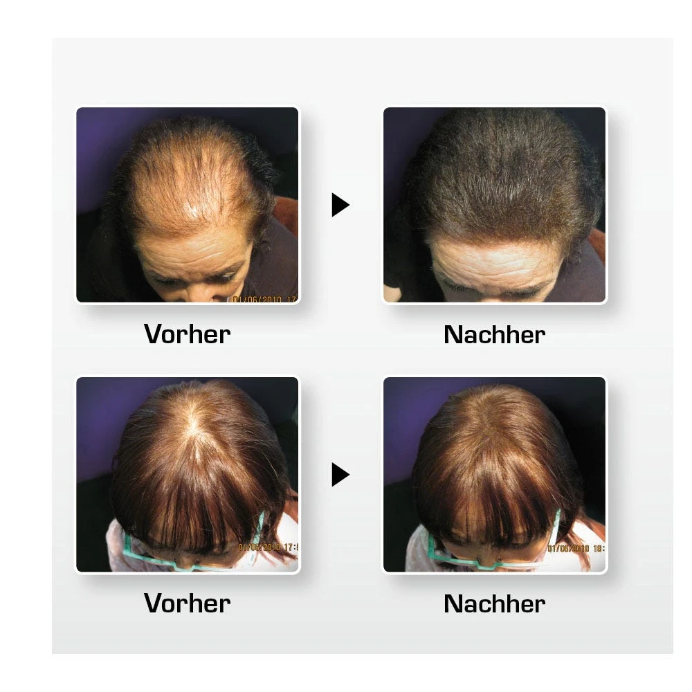 BioThik Haaraufbau-Faser S7 Hellblond 25 G 3 BioThik Haaraufbau-Faser S7 Hellblond 25 G – Bild 3