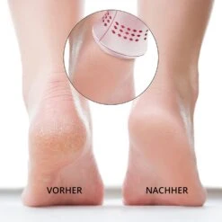 Ailoria Lustre Elektrischer Hornhautentferner Mint -Pflegemittelgeschäft 12105367 3